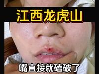 江西龙虎山，我不需要任何说法，避雷就行了